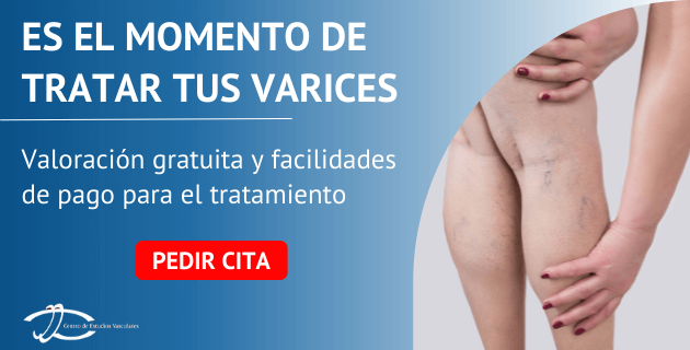cita varices