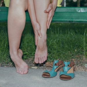 Cómo afecta el calor a las varices