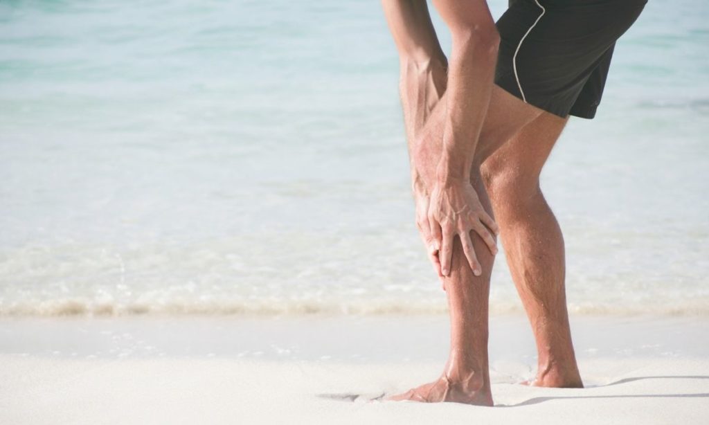 Cómo afecta el calor a las varices