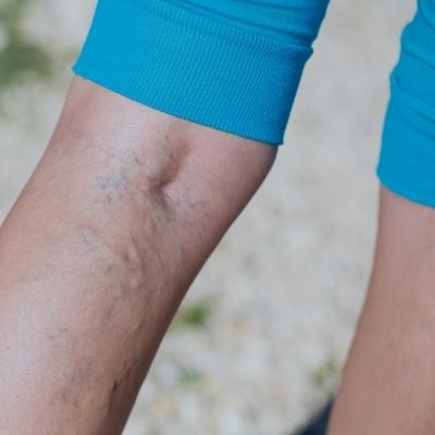 Cómo afecta las altas temperaturas