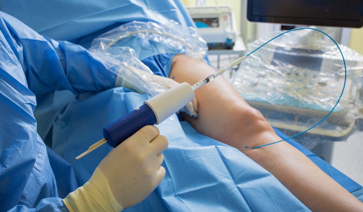 adhesivo médico varices